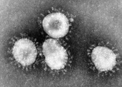 Virions d'un coronavirus observés au microscope électronique (source: CDC/Dr. Fred Murphy)